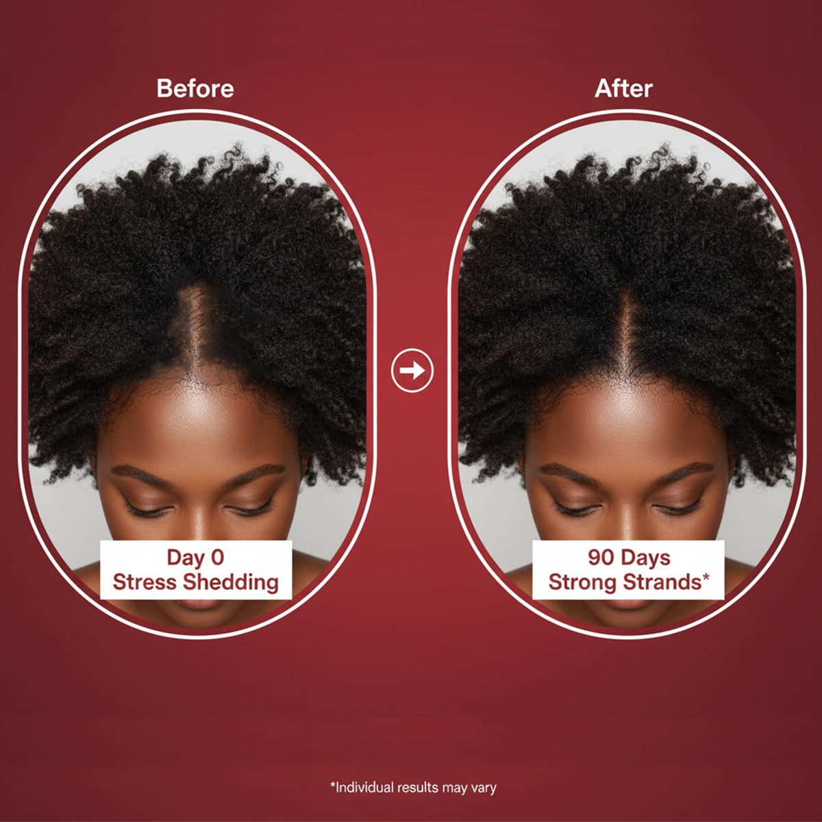 Lumin Hair Growth Gummies for Black Women, 60 Vegan Gummies, Daily Hair Nourishment with Biotin, Collagen & Botanical Extracts, Supports Healthy Hair Growth & Strength Lumin HairBuy Supplements Australia