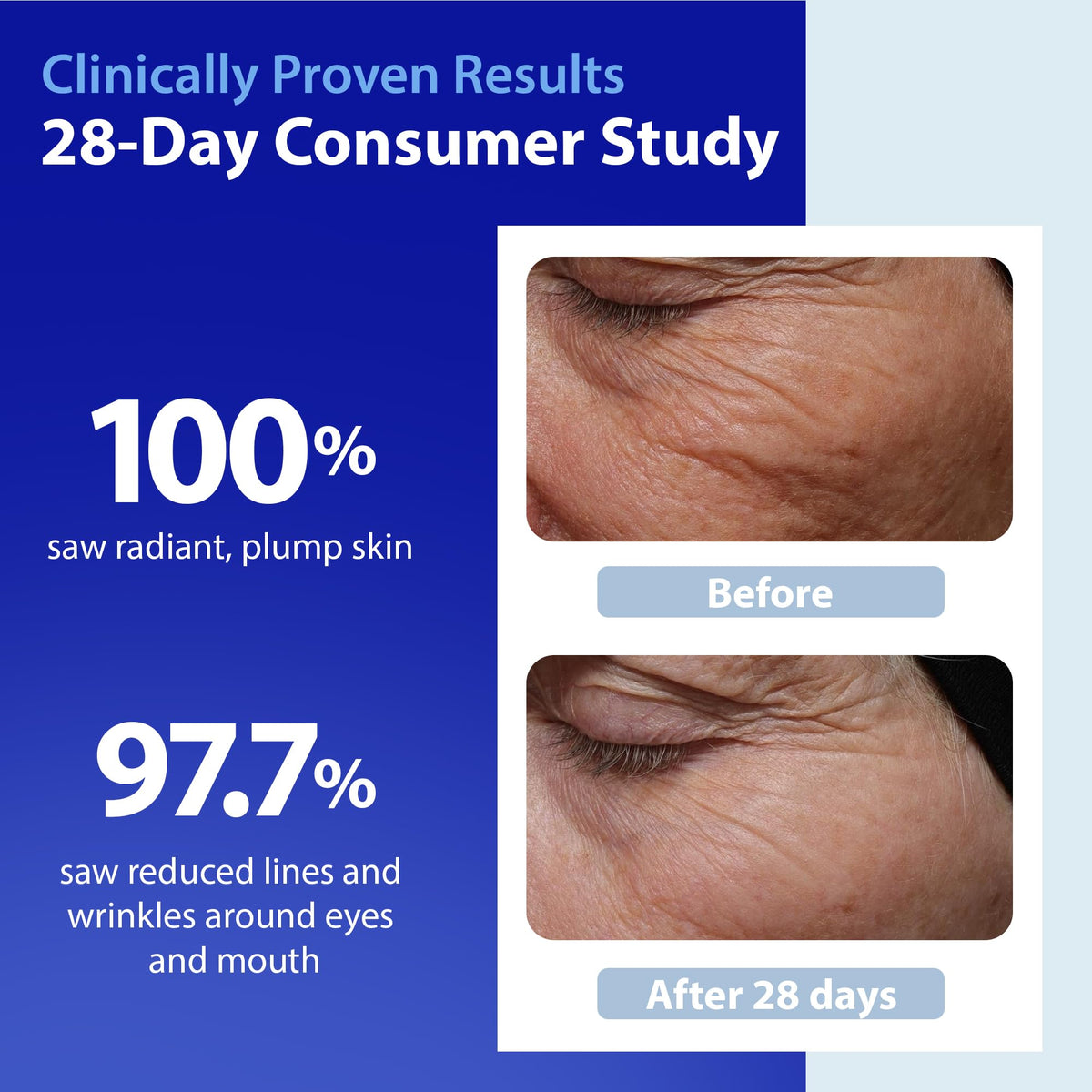 Dr. Denese SkinScience HydroShield Retinol Serum for Face 4 oz – Dermatologist Tested Hydrating Serum, Contains Retinol and Ceramides for Deep Moisture - Cruelty Free Dr. Denese buy supplements Au