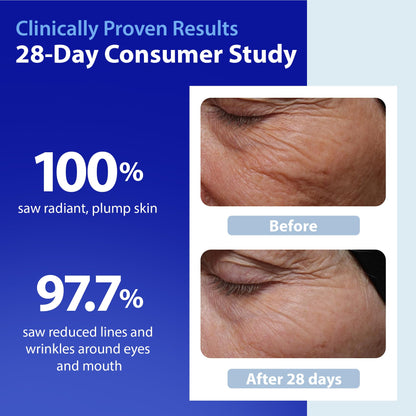 Dr. Denese SkinScience HydroShield Retinol Serum for Face 4 oz – Dermatologist Tested Hydrating Serum, Contains Retinol and Ceramides for Deep Moisture - Cruelty Free Dr. Denese buy supplements Au