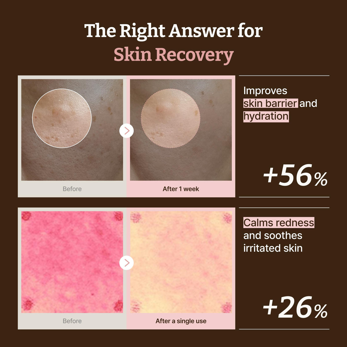 Dr.Reju-All Advanced PDRN Rejuvenating Cream Max – 99% Pure Salmon DNA Gel Type Face Moisturizer – Optimal 1200ppm for Glass Skin & Plumping – Korean Pharmacy Anti-Aging Skin Care Face Cream -2 Fl Oz Dr.Reju-All buy supplements Au