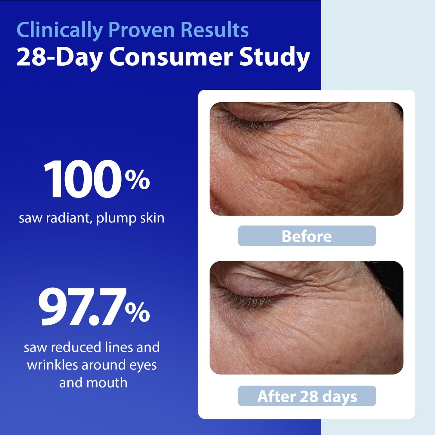 Dr. Denese SkinScience HydroShield Retinol Serum for Face 1 oz – Dermatologist Tested Hydrating Serum, Contains Retinol and Ceramides for Deep Moisture - Cruelty Free Dr. Denese buy supplements Au