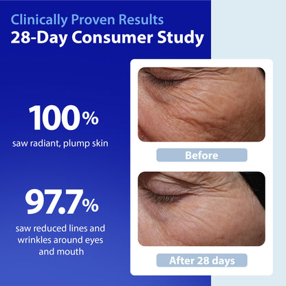 Dr. Denese SkinScience HydroShield Retinol Serum for Face 1 oz – Dermatologist Tested Hydrating Serum, Contains Retinol and Ceramides for Deep Moisture - Cruelty Free Dr. Denese buy supplements Au