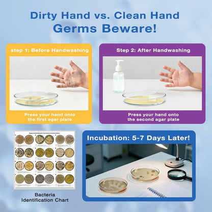 Giant Microbiology Bacteria Science Kit for Kids:2 XL 150mm Prepoured Nutrient Agar Plates, Petri Dishes with Agar & Colony Characteristics Poster for School Projects & Educational Gifts MosynexBuy Supplements Australia