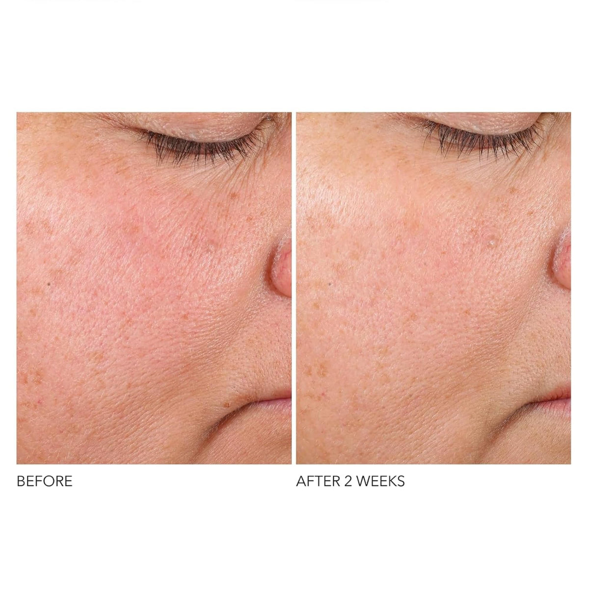 Dr. Dennis Gross Advanced Retinol + Ferulic Texture Renewal Serum – Anti-Aging Formula to Smooth Texture, Boost Radiance, and Minimize Fine Lines & Wrinkles, 1 oz Dr Dennis Gross buy supplements Au
