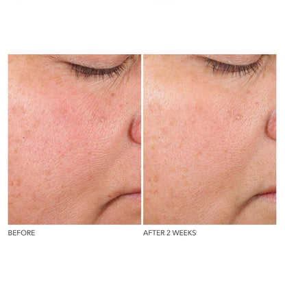 Dr. Dennis Gross Advanced Retinol + Ferulic Texture Renewal Serum – Anti-Aging Formula to Smooth Texture, Boost Radiance, and Minimize Fine Lines & Wrinkles, 1 oz Dr Dennis Gross buy supplements Au