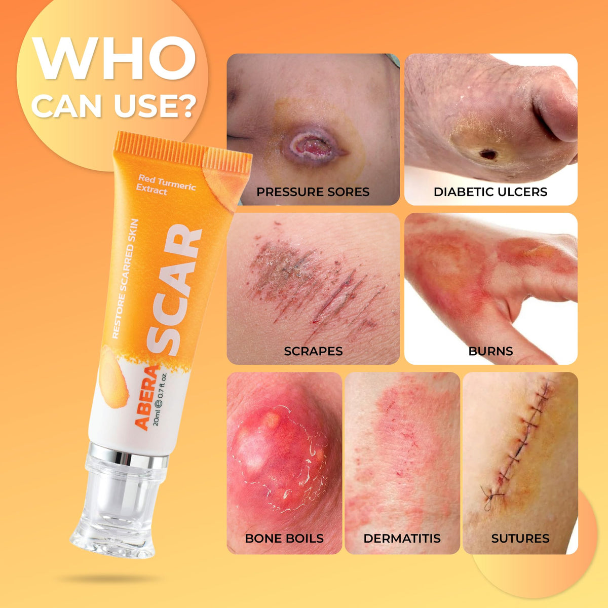 ABERA Scar Removal Cream for Women and Men - Rapid Repair of New Old Scars, Spots, Burns All Natural Treatment with Vitamin E, Alanine, Collagen (1 Box + 3 Eye Patch) ABERABuy Supplements Australia