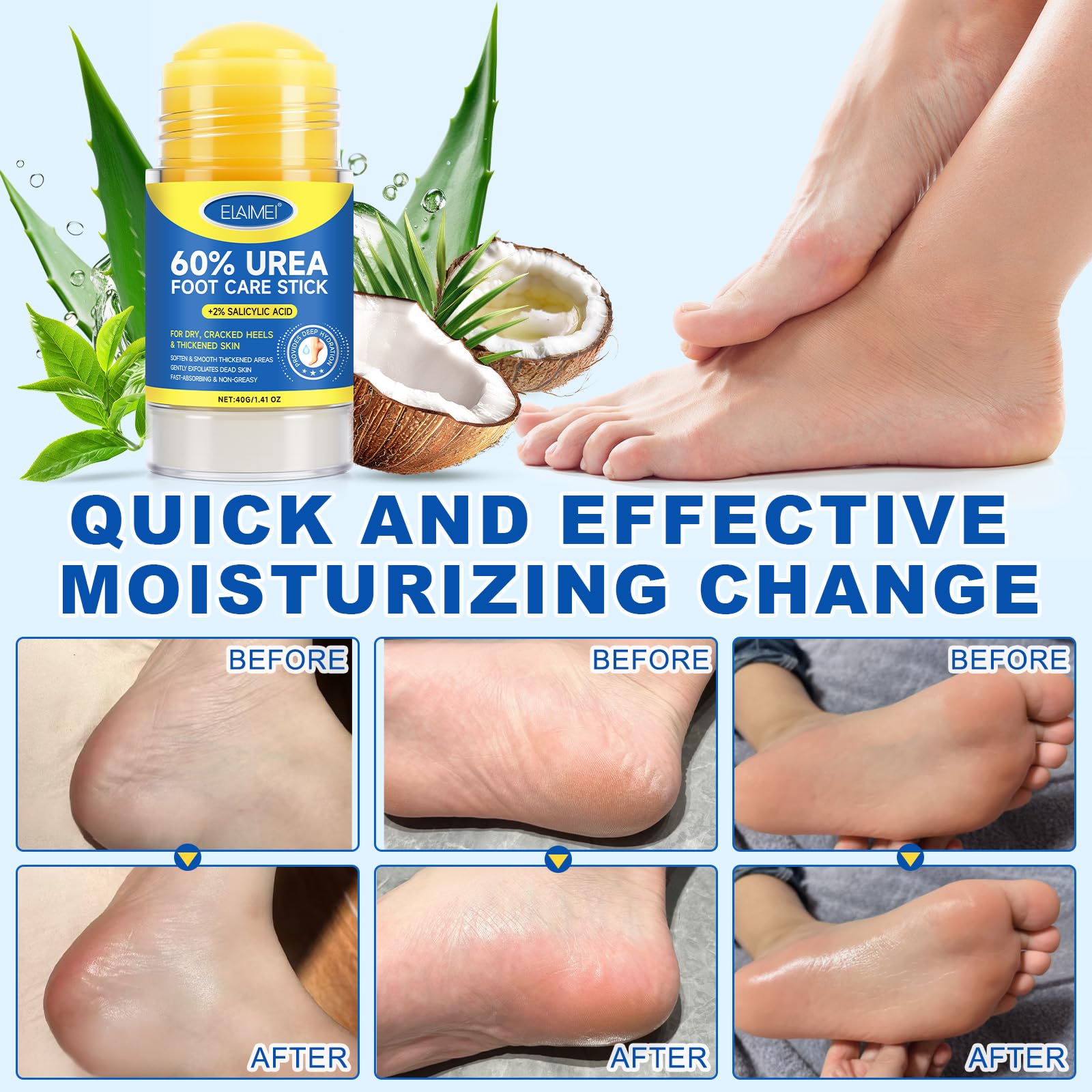 FANSHI 2 PCS Urea Stick 60% High Potency, Foot Care Urea Stick for Deeply Moisturizing & Fast Absorbing, Exfoliation for Dry Cracked Heels & Thickened Skin FANSHI buy supplements Au