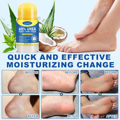 FANSHI 2 PCS Urea Stick 60% High Potency, Foot Care Urea Stick for Deeply Moisturizing & Fast Absorbing, Exfoliation for Dry Cracked Heels & Thickened Skin FANSHI buy supplements Au