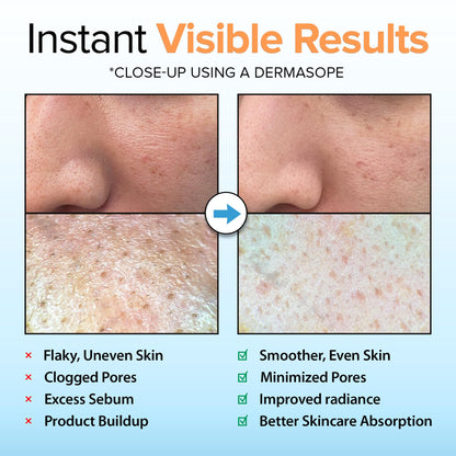 Ebanel Brightening Peeling Gel with Cotton Cellulose, Rice, Papaya, Centella, Hyaluronic Acid for Face and Body, Gentle Exfoliating Face Scrub Gel Peel Wash, Deep Pore Cleanser Minimizer Exfoliator Ebanel buy supplements Au