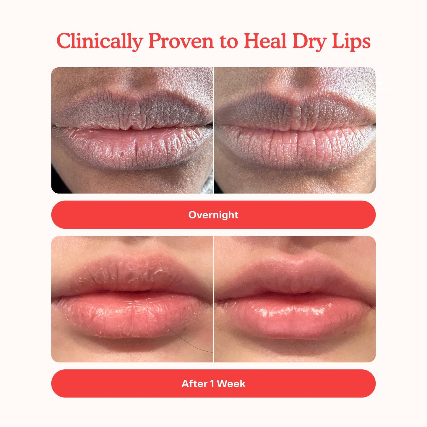 Tower 28 LipSoftie Tinted Lip Balm Treatment - Hydrating Glossy Balm + Overnight Lip Mask with Jojoba Oil + Shea Butter - Sweet