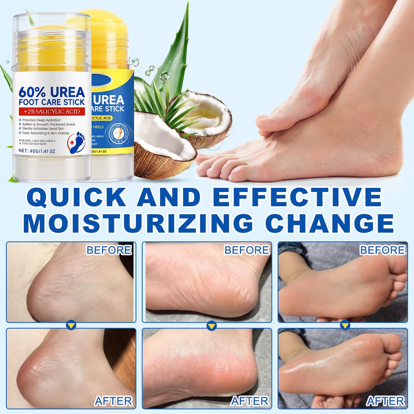 Loobexery 2 Pcs 60% Urea with 2% Salicylic Acid Foot Care Stick, Urea Foot Cream for Cracked Feet, Repairs Dry Rough Heels Fast, Foot Lotion Moisturizer for Dead Skin, Hydrating Heel Balm Loobexery buy supplements Au