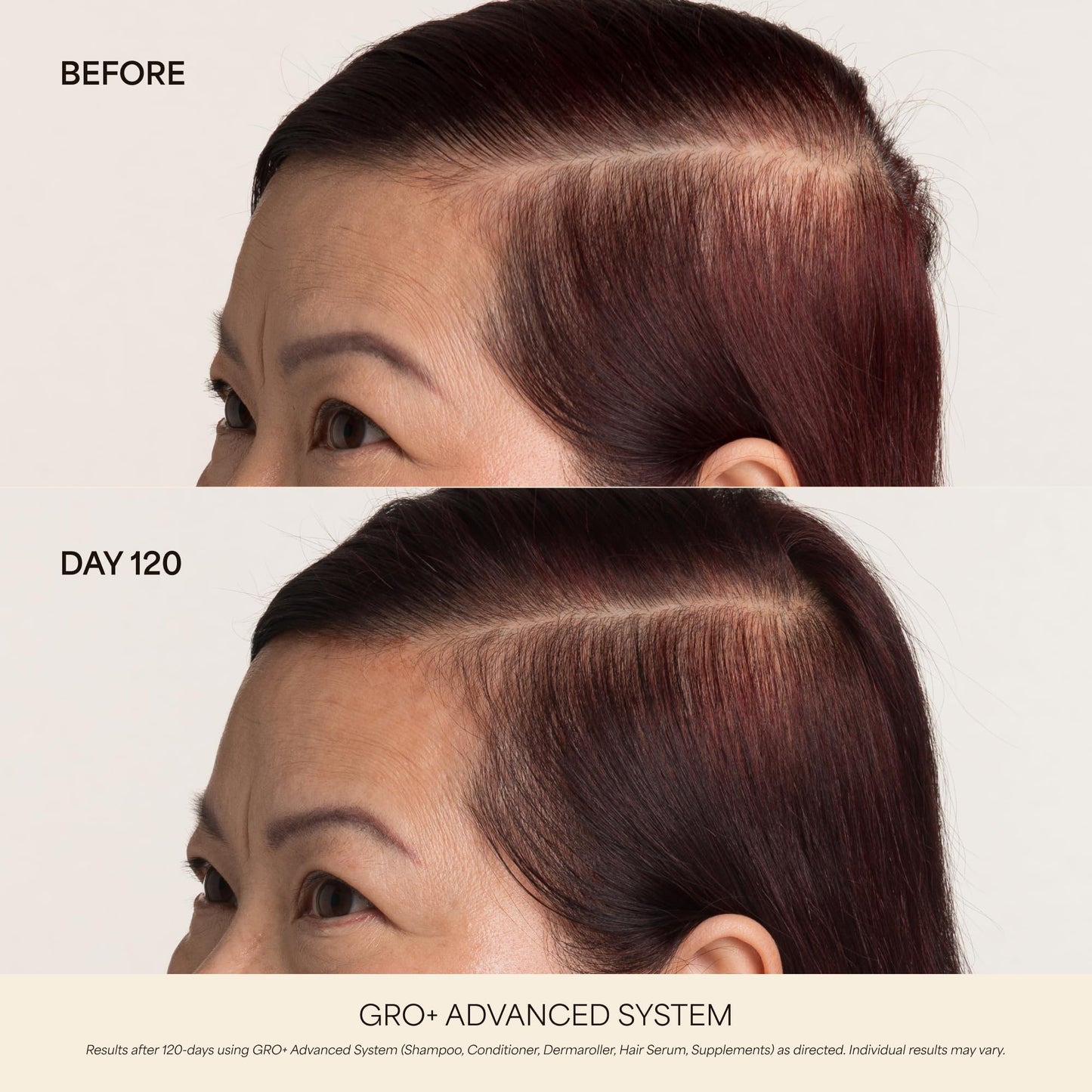 VEGAMOUR GRO+ Advanced Hair Growth Vitamin Supplements - Boosts Hair Growth & Density - 30 Pill Packs/Box VEGAMOURBuy Supplements Australia