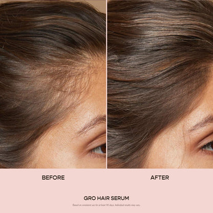 VEGAMOUR GRO Hair Serum for Hair Thinning, Thicker Fuller Looking Hair, Non Oily Tonic for Healthier Scalp, 30 day Supply 1.0 fl oz, 1 pack VEGAMOURBuy Supplements Australia
