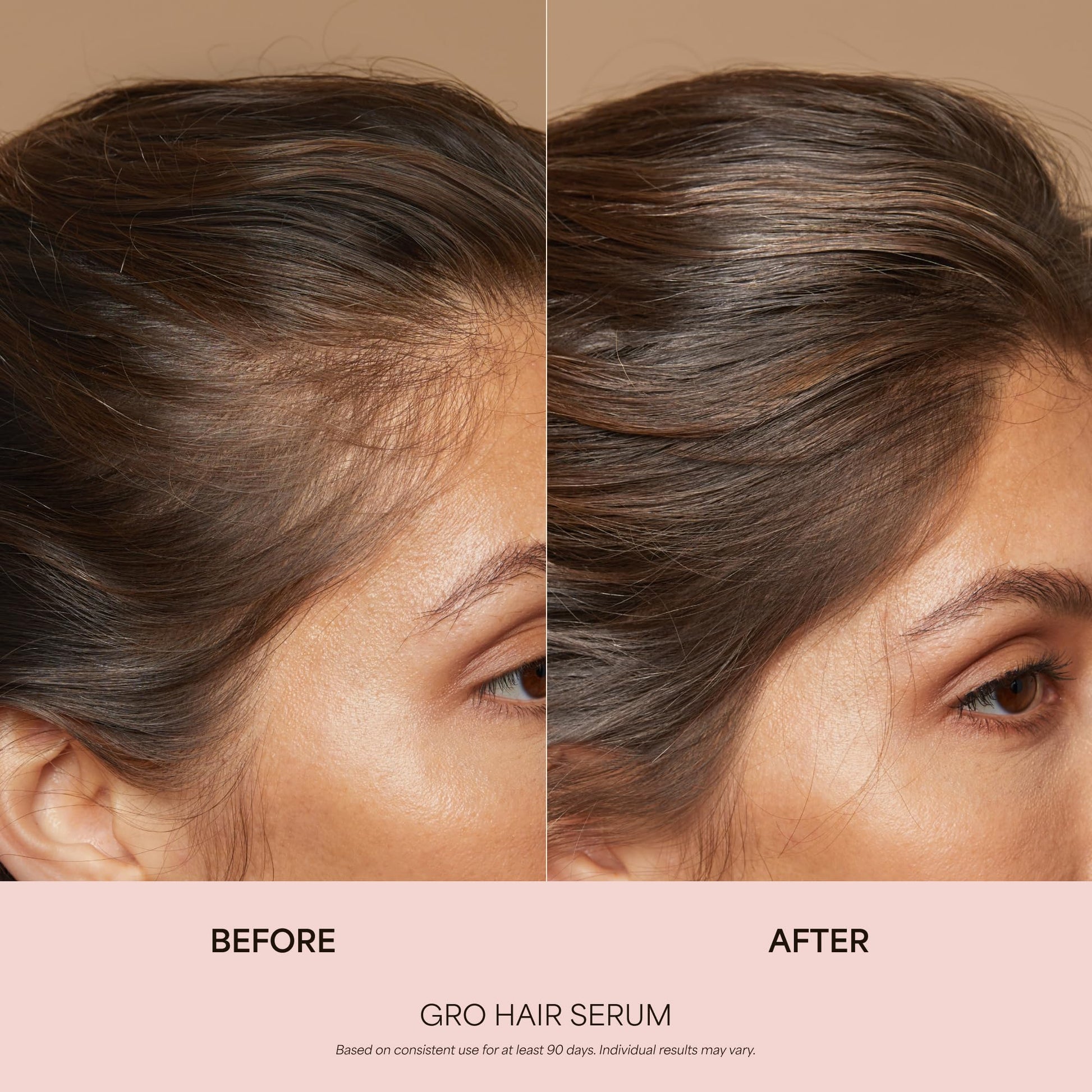 VEGAMOUR GRO Healthy Hair Starter Kit | Full Size GRO Serum for Thinning & Shedding plus Travel Size Shampoo and Conditioner with Vegan Keratin to Support Thicker, Fuller Looking Locks | $92 Value VEGAMOURBuy Supplements Australia