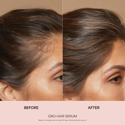 VEGAMOUR GRO Healthy Hair Starter Kit | Full Size GRO Serum for Thinning & Shedding plus Travel Size Shampoo and Conditioner with Vegan Keratin to Support Thicker, Fuller Looking Locks | $92 Value VEGAMOURBuy Supplements Australia