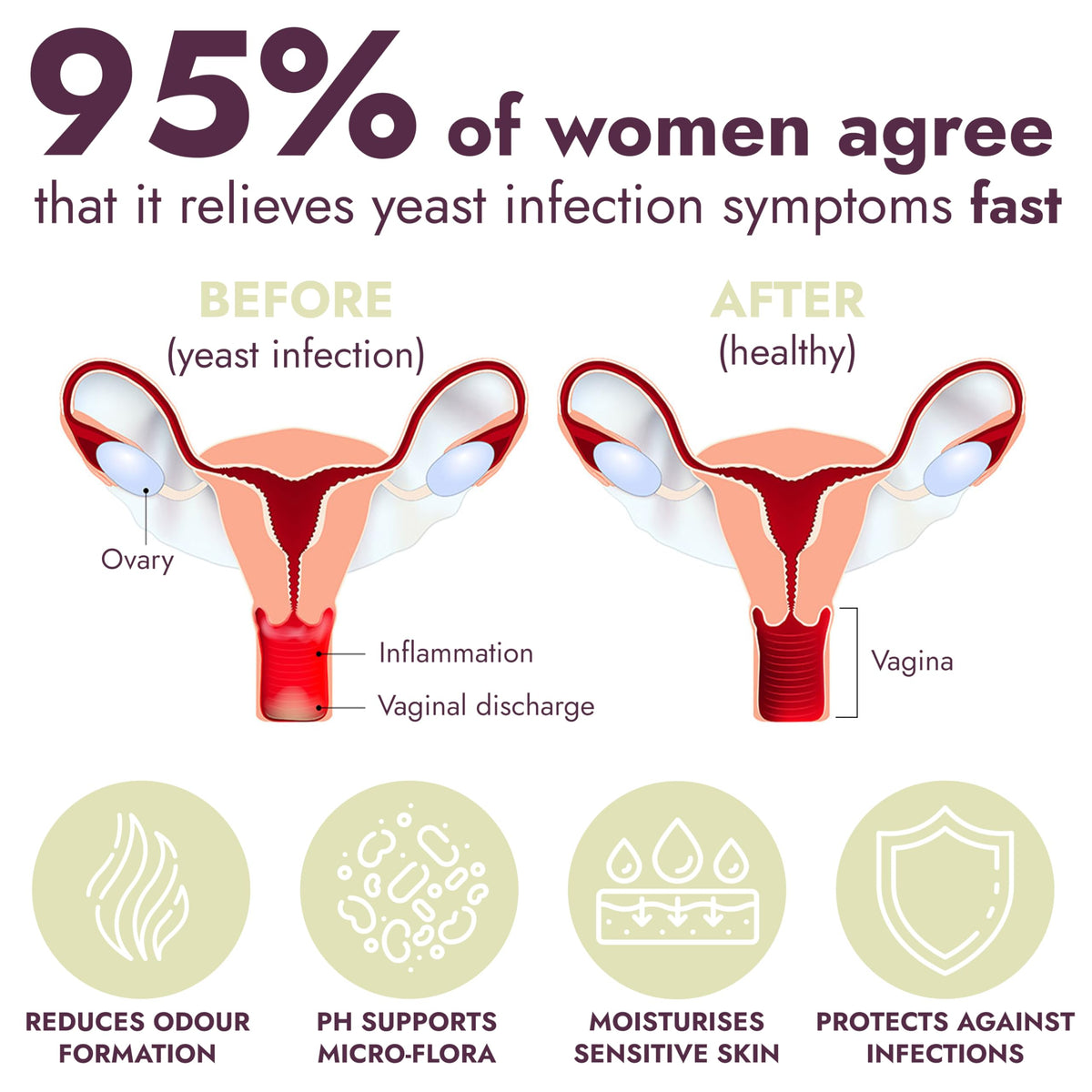 Yeast Infection Treatment for Women | Boric Acid Suppositories For Women | Helps Relieve Itching & Irritation | Vaginal Aid for Inflammation, Dryness & Watery Discharge | 12 Vaginal Suppositories Terramed Just Think ComfortBuy Supplements Australia