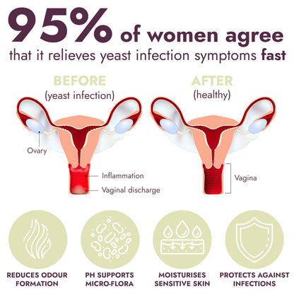 Yeast Infection Treatment for Women | Boric Acid Suppositories For Women | Helps Relieve Itching & Irritation | Vaginal Aid for Inflammation, Dryness & Watery Discharge | 12 Vaginal Suppositories Terramed Just Think ComfortBuy Supplements Australia