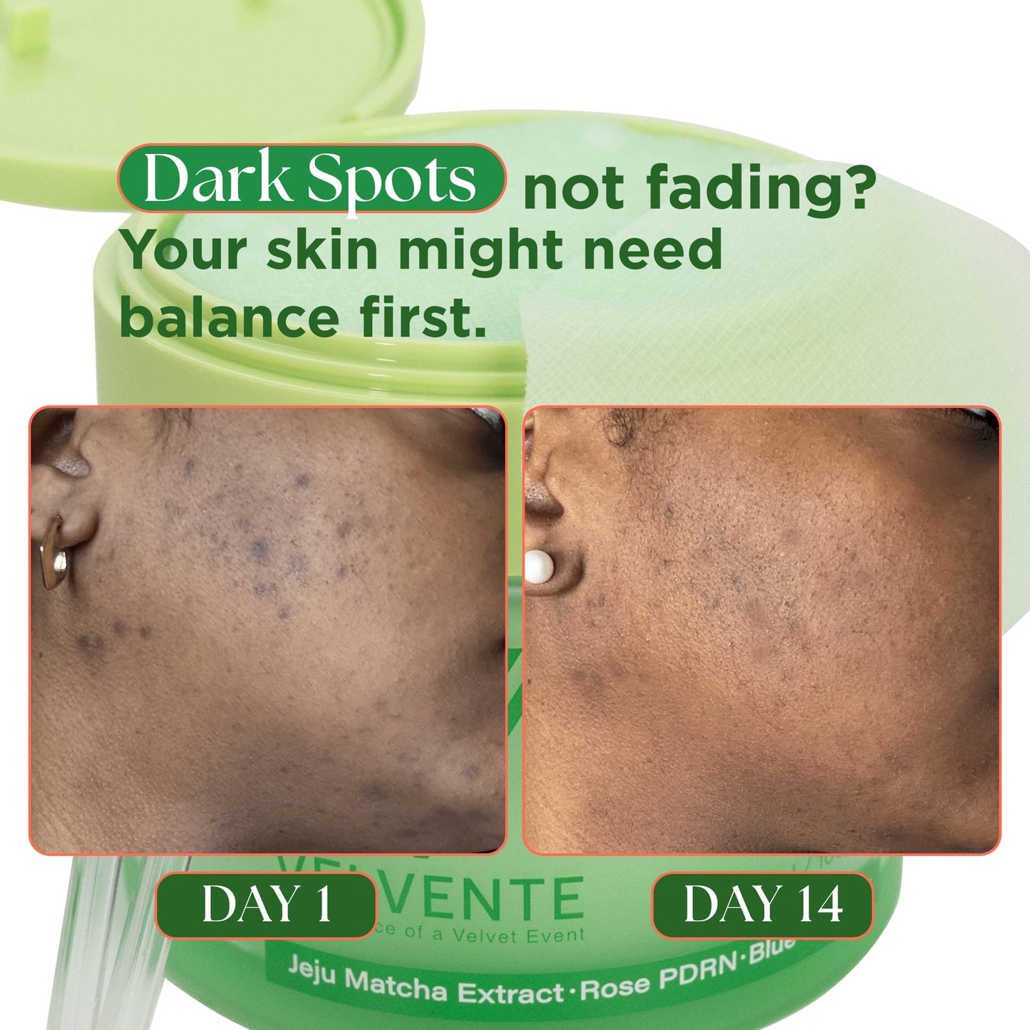 VELVENTE Matcha Gentle Deep Pore Cleansing Facial Cleanser, Low-pH Face Wash for Pore Refining, Rose PDRN Hydrating Daily Facial Wash Redness & Sensitive Skin Friendly, Korean Skincare(5.07 fl.oz.) VELVENTE buy supplements Au