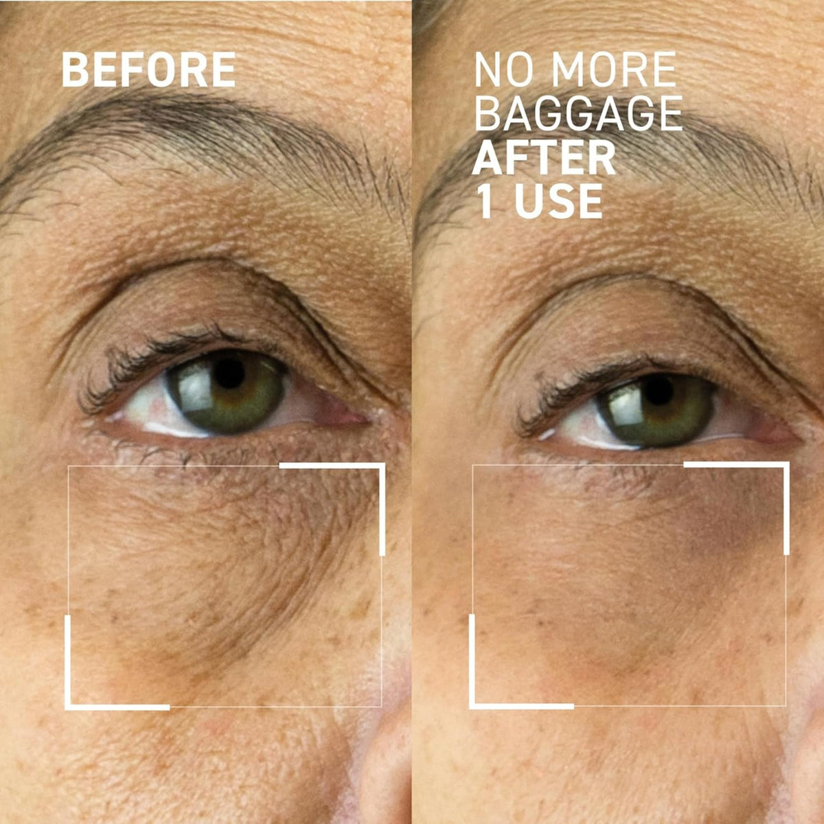 Dr. Brandt Needles No More, No More Baggage Bundle - Minimizes Under-Eye Bags, Puffiness & Dark Circles - Full (0.5 oz) + Travel Size (0.25 oz) Dr. Brandt Skincare buy supplements Au